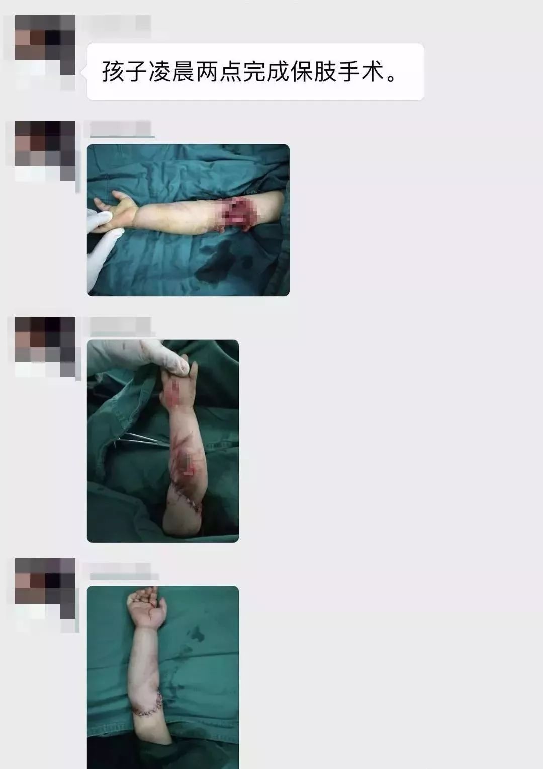 女童坐滑梯夹断小拇指，赔偿难题待解